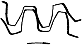 �X݆�����g(sh��)�Zһ�㶨�x